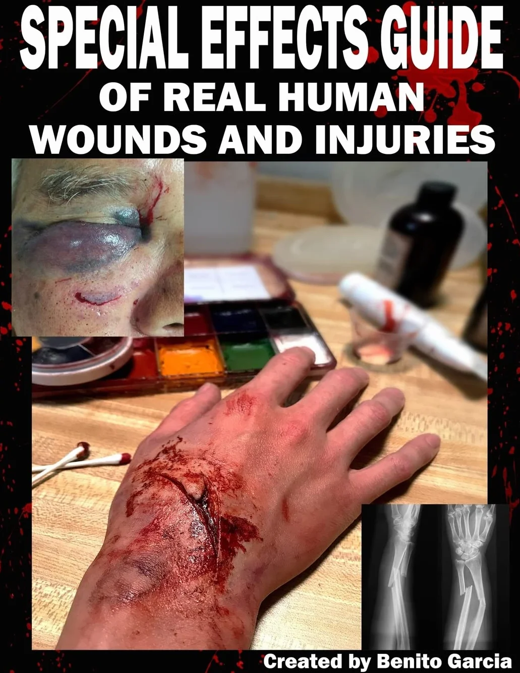 Special Effects Guide Of Real Human Wounds and Injuries: Special Effects Guide Of Real Human Wounds and Injuries