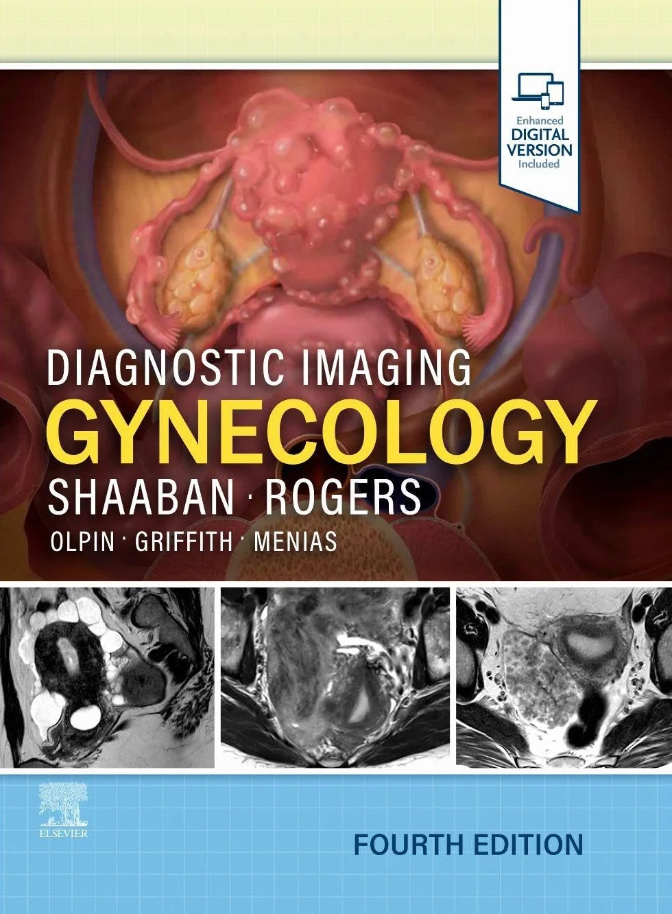 Diagnostic Imaging: Gynecology