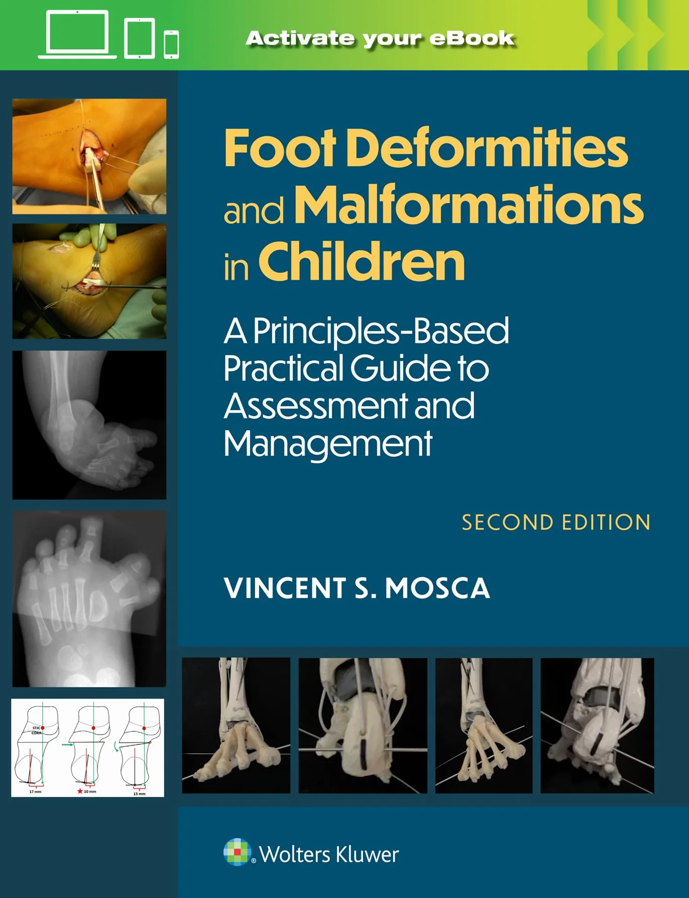 Foot Deformities and Malformations in Children: A Principles-Based, Practical Guide to Assessment and Management: Print + eBook with Multimedia