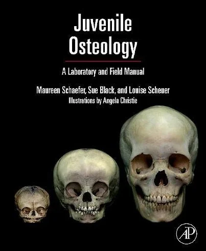 Juvenile Osteology: A Laboratory and Field Manual