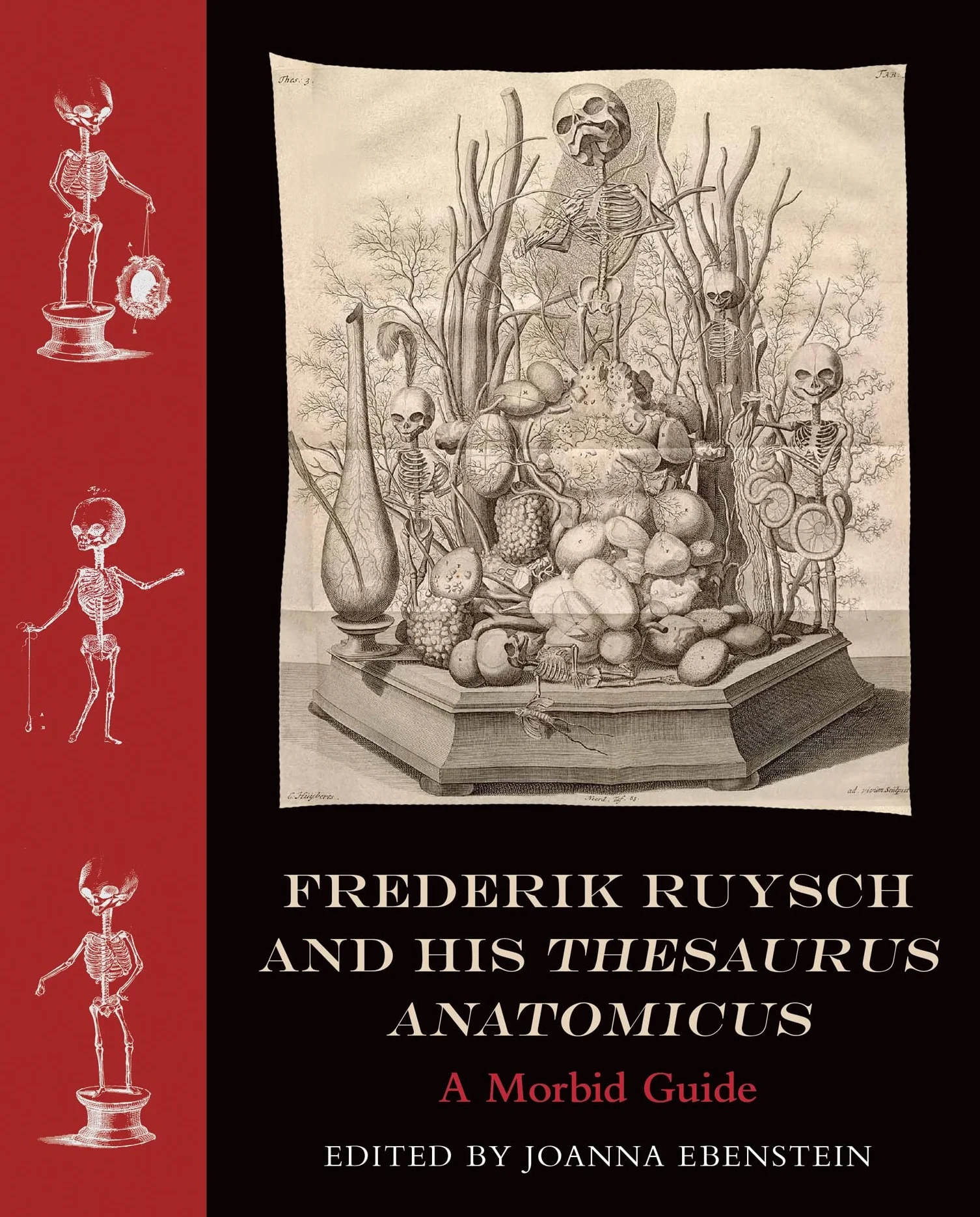 Frederik Ruysch and His Thesaurus Anatomicus: A Morbid Guide