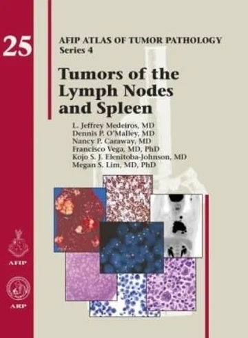 Tumors of the Lymph Nodes and Spleen: No. 25