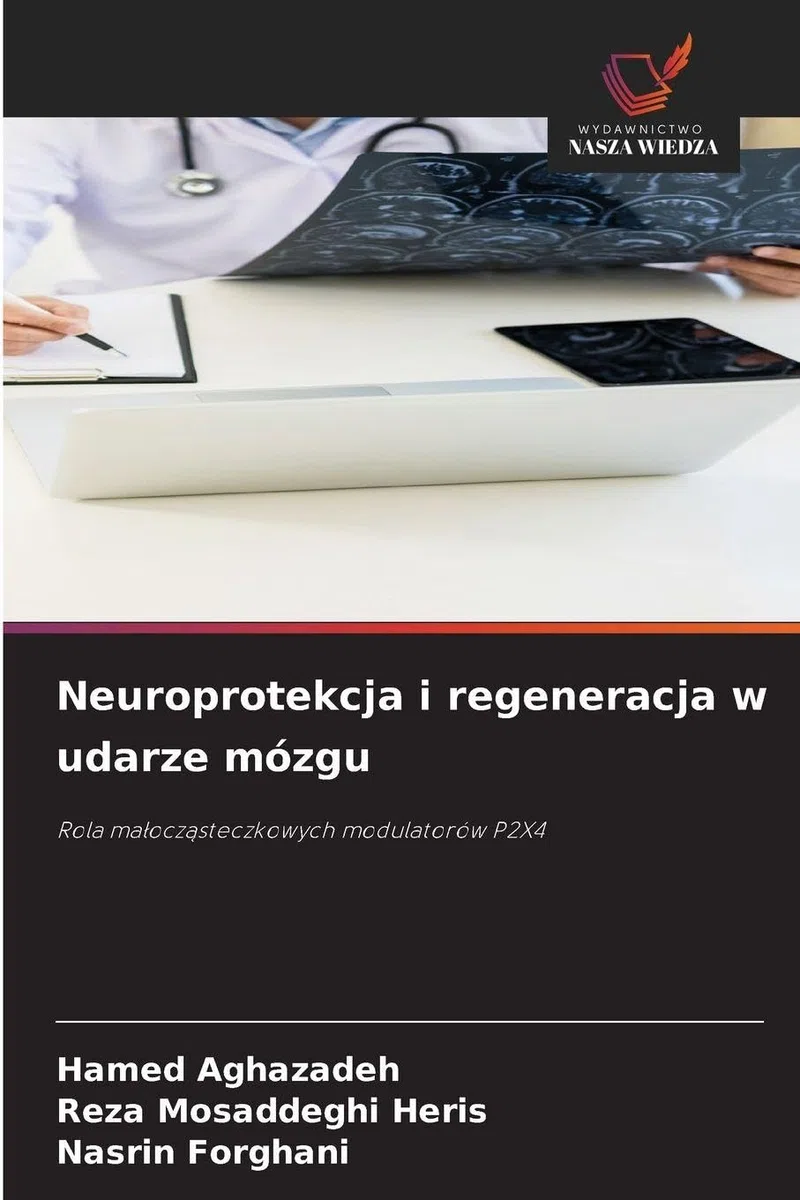 Neuroprotekcja i regeneracja w udarze mózgu: Rola ma¿ocz¿steczkowych modulatorów P2X4