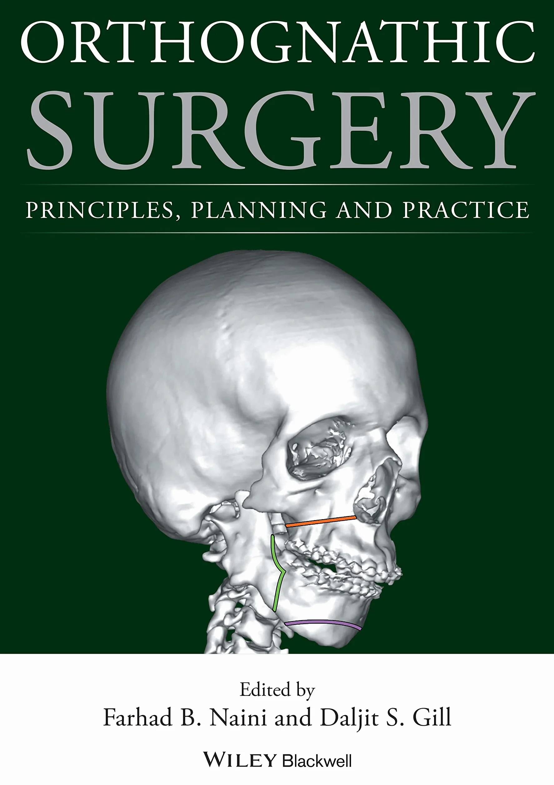 Orthognathic Surgery: Principles, Planning and Practice