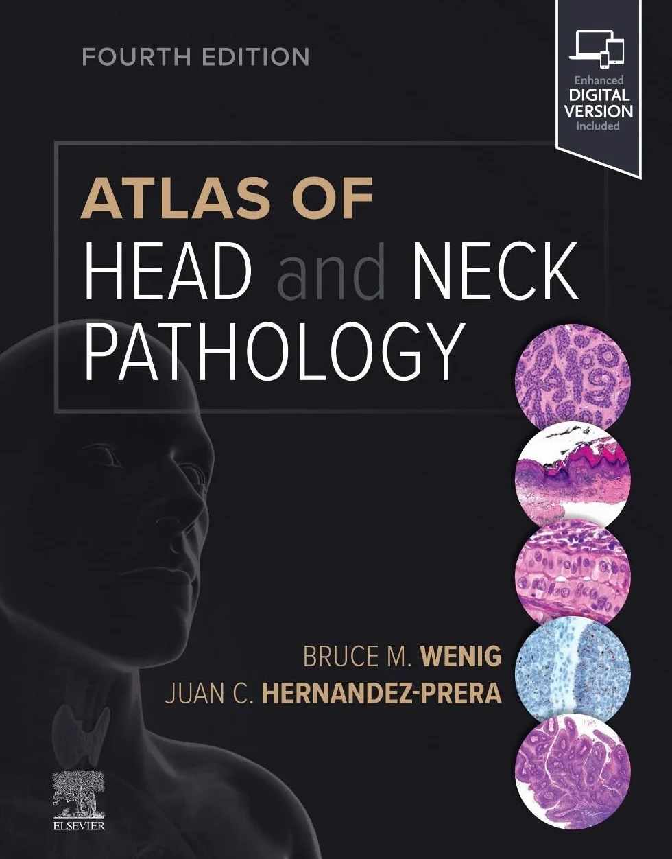 Atlas of Head and Neck Pathology