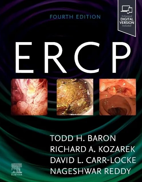 Ercp