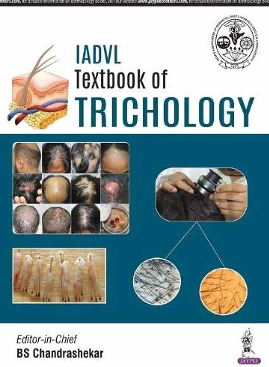 IADVL Textbook of Trichology